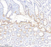 Immunohistochemical staining of PLS1 using anti-PLS1 antibody. PLS1 was detected in a paraffin-embedded section of human colon tissue. Heat mediated antigen retrieval was performed in EDTA buffer (pH 8.0, epitope retrieval solution). The tissue section was blocked with 10% goat serum. The tissue section was then incubated with 2 ug/ml rabbit anti-PLS1 antibody overnight at 4oC. Peroxidase Conjugated Goat Anti-rabbit IgG was used as secondary antibody and incubated for 30 minutes at 37oC. The tissue section was developed using an HRP secondary and DAB substrate.