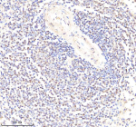 Immunohistochemical staining of PYK2/PTK2B using anti-PTK2B antibody. PYK2/PTK2B was detected in a paraffin-embedded section of human spleen tissue. Heat mediated antigen retrieval was performed in EDTA buffer (pH 8.0, epitope retrieval solution). The tissue section was blocked with 10% goat serum. The tissue section was then incubated with 2 ug/ml rabbit anti-PTK2B antibody overnight at 4oC. Peroxidase Conjugated Goat Anti-rabbit IgG was used as secondary antibody and incubated for 30 minutes at 37oC. The tissue section was developed using an HRP secondary and DAB substrate.