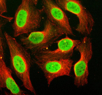 Immunofluorescent staining of CBX6 using anti-CBX6 antibody (green) and anti-Beta Tubulin antibody (red). CBX6 was detected in an immunocytochemical section of U2OS cells. Enzyme antigen retrieval was performed using IHC enzyme antigen retrieval reagent for 15 mins. The cells were blocked with 10% goat serum. And then incubated with 5 ug/ml rabbit anti-CBX6 antibody and mouse anti-Beta Tubulin antibody overnight at 4oC. DyLight 488 Conjugated Goat Anti-Rabbit IgG and Cy3 Conjugated Goat Anti-Mouse IgG were used as secondary antibody at 1:500 dilution and incubated for 30 minutes at 37oC. Visualize using a fluorescence microscope and filter sets appropriate for the label used.