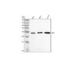 Western blot analysis of IER3 using anti-IER3 antibody. Electrophoresis was performed on a 12% SDS-PAGE gel at 80V (Stacking gel) / 120V (Resolving gel) for 2 hours. Lane 1: human RT4 whole cell lysates, Lane 2: human 293T whole cell lysates, Lane 3: human Jurkat whole cell lysates. After electrophoresis, proteins were transferred to a nitrocellulose membrane at 150 mA for 50-90 minutes. Blocked the membrane with 5% non-fat milk/TBS for 1.5 hour at RT. The membrane was incubated with rabbit anti-IER3 antibody at 0.5 ug/ml overnight at 4oC, then washed with TBS-0.1%Tween 3 times with 5 minutes each and probed with a goat anti-rabbit IgG-HRP secondary antibody at a dilution of 1:5000 for 1.5 hour at RT. The signal was developed using an ECL Plus Western Blotting Substrate. A band at ~23 kDa is detected across samples, running higher than the ~17 kDa prediction. The upward shift is consistent with the known anomalous migration of the acidic, serine-rich IER3 protein and phosphorylation-dependent mobility differences reported in cell stress conditions.