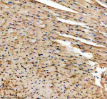 Immunohistochemical staining of TMOD1 using anti-TMOD1 antibody. TMOD1 was detected in a paraffin-embedded section of mouse heart tissue. Heat mediated antigen retrieval was performed in EDTA buffer (pH 8.0, epitope retrieval solution). The tissue section was blocked with 10% goat serum. The tissue section was then incubated with 2 ug/ml rabbit anti-TMOD1 antibody overnight at 4oC. Peroxidase Conjugated Goat Anti-rabbit IgG was used as secondary antibody and incubated for 30 minutes at 37oC. The tissue section was developed using an HRP secondary and DAB substrate.