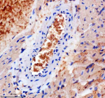 Immunohistochemical staining of TMOD1 using anti-TMOD1 antibody. TMOD1 was detected in a paraffin-embedded section of rat erythrocyte tissue. Heat mediated antigen retrieval was performed in EDTA buffer (pH 8.0, epitope retrieval solution). The tissue section was blocked with 10% goat serum. The tissue section was then incubated with 2 ug/ml rabbit anti-TMOD1 antibody overnight at 4oC. Peroxidase Conjugated Goat Anti-rabbit IgG was used as secondary antibody and incubated for 30 minutes at 37oC. The tissue section was developed using an HRP secondary and DAB substrate.
