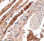 Immunohistochemical staining of TMOD1 using anti-TMOD1 antibody. TMOD1 was detected in a paraffin-embedded section of mouse erythrocyte tissue. Heat mediated antigen retrieval was performed in EDTA buffer (pH 8.0, epitope retrieval solution). The tissue section was blocked with 10% goat serum. The tissue section was then incubated with 2 ug/ml rabbit anti-TMOD1 antibody overnight at 4oC. Peroxidase Conjugated Goat Anti-rabbit IgG was used as secondary antibody and incubated for 30 minutes at 37oC. The tissue section was developed using an HRP secondary and DAB substrate.