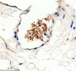 Immunohistochemical staining of TMOD1 using anti-TMOD1 antibody. TMOD1 was detected in a paraffin-embedded section of human erythrocyte tissue. Heat mediated antigen retrieval was performed in EDTA buffer (pH 8.0, epitope retrieval solution). The tissue section was blocked with 10% goat serum. The tissue section was then incubated with 2 ug/ml rabbit anti-TMOD1 antibody overnight at 4oC. Peroxidase Conjugated Goat Anti-rabbit IgG was used as secondary antibody and incubated for 30 minutes at 37oC. The tissue section was developed using an HRP secondary and DAB substrate.
