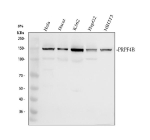 Western blot analysis of PRP4K using anti-PRP4K antibody. Electrophoresis was performed on a 8% SDS-PAGE gel at 80V (Stacking gel) / 120V (Resolving gel) for 2 hours. Lane 1: human Hela whole cell lysates, Lane 2: human Hacat whole cell lysates, Lane 3: human K562 whole cell lysates, Lane 4: human HepG2 whole cell lysates, Lane 5: mouse NIH/3T3 whole cell lysates. After electrophoresis, proteins were transferred to a nitrocellulose membrane at 150 mA for 50-90 minutes. Blocked the membrane with 5% non-fat milk/TBS for 1.5 hour at RT. The membrane was incubated with rabbit anti-PRP4K antibody at 0.5 ug/ml overnight at 4oC, then washed with TBS-0.1%Tween 3 times with 5 minutes each and probed with a goat anti-rabbit IgG-HRP secondary antibody at a dilution of 1:5000 for 1.5 hour at RT. The signal was developed using an ECL Plus Western Blotting Substrate. A strong band at ~140-150 kDa is detected in human cell lysates, with a weaker band just above the 100 kDa marker. The higher migration is consistent with hyperphosphorylated PRP4K, while the lower band represents hypo-phosphorylated or truncated protein.