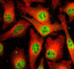 Immunofluorescent staining of PRP4K using anti-PRP4K antibody (green) and anti-Beta Tubulin antibody (red). PRP4K was detected in an immunocytochemical section of Hela cells. Enzyme antigen retrieval was performed using IHC enzyme antigen retrieval reagent for 15 mins. The cells were blocked with 10% goat serum. And then incubated with 5 ug/ml rabbit anti-PRP4K antibody and mouse anti-Beta Tubulin antibody overnight at 4oC. DyLight 488 Conjugated Goat Anti-Rabbit IgG and Cy3 Conjugated Goat Anti-Mouse IgG were used as secondary antibody at 1:500 dilution and incubated for 30 minutes at 37oC. Visualize using a fluorescence microscope and filter sets appropriate for the label used.