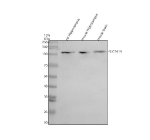 Western blot analysis of SLC7A14 using anti-SLC7A14 antibody. Electrophoresis was performed on a 10% SDS-PAGE gel at 80V (Stacking gel) / 120V (Resolving gel) for 2 hours. Lane 1: rat hippocampus tissue lysates, Lane 2: mouse hippocampus tissue lysates, Lane 3: mouse brain tissue lysates. After electrophoresis, proteins were transferred to a nitrocellulose membrane at 150 mA for 50-90 minutes. Blocked the membrane with 5% non-fat milk/TBS for 1.5 hour at RT. The membrane was incubated with rabbit anti-SLC7A14 antibody at 0.5 ug/ml overnight at 4oC, then washed with TBS-0.1%Tween 3 times with 5 minutes each and probed with a goat anti-rabbit IgG-HRP secondary antibody at a dilution of 1:5000 for 1.5 hour at RT. The signal was developed using an ECL Plus Western Blotting Substrate. A specific band was detected for SLC7A14 at approximately 84 kDa. The expected molecular weight of SLC7A14 is ~84 kDa.