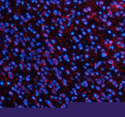 Immunofluorescent staining of SLC7A14 using anti-SLC7A14 antibody (red). SLC7A14 was detected in a paraffin-embedded section of rat brain tissue. Heat mediated antigen retrieval was performed in EDTA buffer (pH 8.0, epitope retrieval solution). The tissue section was blocked with 10% goat serum. The tissue section was then incubated with 5 ug/ml rabbit anti-SLC7A14 antibody overnight at 4oC. Cy3 Conjugated Goat Anti-Rabbit IgG was used as secondary antibody at 1:500 dilution and incubated for 30 minutes at 37oC. The section was counterstained with DAPI nuclear stain (blue). Visualize using a fluorescence microscope and filter sets appropriate for the label used.