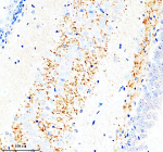 Immunohistochemical staining of SLC7A14 using anti-SLC7A14 antibody. SLC7A14 was detected in a paraffin-embedded section of rat brain tissue. Heat mediated antigen retrieval was performed in EDTA buffer (pH 8.0, epitope retrieval solution). The tissue section was blocked with 10% goat serum. The tissue section was then incubated with 2 ug/ml rabbit anti-SLC7A14 antibody overnight at 4oC. Peroxidase Conjugated Goat Anti-rabbit IgG was used as secondary antibody and incubated for 30 minutes at 37oC. The tissue section was developed using an HRP secondary and DAB substrate.
