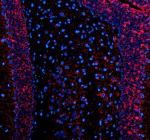 Immunofluorescent staining of SLC7A14 using anti-SLC7A14 antibody (red). SLC7A14 was detected in a paraffin-embedded section of rat brain tissue. Heat mediated antigen retrieval was performed in EDTA buffer (pH 8.0, epitope retrieval solution). The tissue section was blocked with 10% goat serum. The tissue section was then incubated with 5 ug/ml rabbit anti-SLC7A14 antibody overnight at 4oC. Cy3 Conjugated Goat Anti-Rabbit IgG was used as secondary antibody at 1:500 dilution and incubated for 30 minutes at 37oC. The section was counterstained with DAPI nuclear stain (blue). Visualize using a fluorescence microscope and filter sets appropriate for the label used.