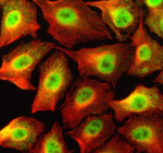 Immunofluorescent staining of NCOR1 using anti-NCOR1 antibody (green) and anti-Beta Tubulin antibody (red). NCOR1 was detected in an immunocytochemical section of cells. Enzyme antigen retrieval was performed using IHC enzyme antigen retrieval reagent for 15 mins. The cells were blocked with 10% goat serum. And then incubated with 5 ug/ml rabbit anti-NCOR1 antibody and mouse anti-Beta Tubulin antibody overnight at 4oC. DyLight 488 Conjugated Goat Anti-Rabbit IgG and Cy3 Conjugated Goat Anti-Mouse IgG were used as secondary antibody at 1:500 dilution and incubated for 30 minutes at 37oC. Visualize using a fluorescence microscope and filter sets appropriate for the label used.
