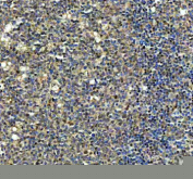 Immunohistochemical staining of NCAPG using anti-NCAPG antibody. NCAPG was detected in a paraffin-embedded section of human tonsil tissue. Heat mediated antigen retrieval was performed in EDTA buffer (pH 8.0, epitope retrieval solution). The tissue section was blocked with 10% goat serum. The tissue section was then incubated with 2 ug/ml rabbit anti-NCAPG antibody overnight at 4oC. Peroxidase Conjugated Goat Anti-rabbit IgG was used as secondary antibody and incubated for 30 minutes at 37oC. The tissue section was developed using an HRP secondary and DAB substrate.