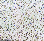 Immunohistochemical staining of Tuberin/TSC2 using anti-Tuberin/TSC2 antibody. Tuberin/TSC2 was detected in a paraffin-embedded section of mouse brain tissue. Heat mediated antigen retrieval was performed in EDTA buffer (pH 8.0, epitope retrieval solution). The tissue section was blocked with 10% goat serum. The tissue section was then incubated with 1:50 rabbit anti-Tuberin/TSC2 antibody overnight at 4oC. Peroxidase Conjugated Goat Anti-rabbit IgG was used as secondary antibody and incubated for 30 minutes at 37oC. The tissue section was developed using an HRP secondary and DAB substrate.