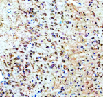 Immunohistochemical staining of Synaptotagmin-10/SYT10 using anti-SYT10 antibody. Synaptotagmin-10/SYT10 was detected in a paraffin-embedded section of rat brain tissue. Heat mediated antigen retrieval was performed in EDTA buffer (pH 8.0, epitope retrieval solution). The tissue section was blocked with 10% goat serum. The tissue section was then incubated with 2 ug/ml rabbit anti-SYT10 antibody overnight at 4oC. Peroxidase Conjugated Goat Anti-rabbit IgG was used as secondary antibody and incubated for 30 minutes at 37oC. The tissue section was developed using an HRP secondary and DAB substrate.