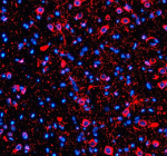 Immunofluorescent staining of Synaptotagmin-10/SYT10 using anti-SYT10 antibody (red). Synaptotagmin-10/SYT10 was detected in a paraffin-embedded section of rat brain tissue. Heat mediated antigen retrieval was performed in EDTA buffer (pH 8.0, epitope retrieval solution). The tissue section was blocked with 10% goat serum. The tissue section was then incubated with 5 ug/ml rabbit anti-SYT10 antibody overnight at 4oC. Cy3 Conjugated Goat Anti-Rabbit IgG was used as secondary antibody at 1:500 dilution and incubated for 30 minutes at 37oC. The section was counterstained with DAPI nuclear stain (blue). Visualize using a fluorescence microscope and filter sets appropriate for the label used.