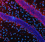 Immunofluorescent staining of Synaptotagmin-10/SYT10 using anti-SYT10 antibody (red). Synaptotagmin-10/SYT10 was detected in a paraffin-embedded section of rat brain tissue. Heat mediated antigen retrieval was performed in EDTA buffer (pH 8.0, epitope retrieval solution). The tissue section was blocked with 10% goat serum. The tissue section was then incubated with 5 ug/ml rabbit anti-SYT10 antibody overnight at 4oC. Cy3 Conjugated Goat Anti-Rabbit IgG was used as secondary antibody at 1:500 dilution and incubated for 30 minutes at 37oC. The section was counterstained with DAPI nuclear stain (blue). Visualize using a fluorescence microscope and filter sets appropriate for the label used.