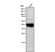 All lanes use the Phospho-CrkL (Tyr207) antibody at 1:1K dilution for 1 hour at room temperature. A tight doublet is detected at ~40 kDa in K562 cells, running above the ~34 kDa predicted mass. The upward shift and doublet pattern are consistent with mono- and hyper-phosphorylated CrkL species, which migrate slower on SDS-PAGE than total CrkL.