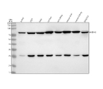 Western blot analysis of HADHA using anti-HADHA antibody. Lane 1: human Jurkat whole cell lysates, Lane 2: human 293T whole cell lysates, Lane 3: human Hela whole cell lysates, Lane 4: rat liver tissue lysates, Lane 5: rat kidney tissue lysates, Lane 6: mouse liver tissue lysates, Lane 7: mouse kidney tissue lysates, Lane 8: mouse NIH/3T3 whole cell lysates. After electrophoresis, proteins were transferred to a nitrocellulose membrane at 150 mA for 50-90 minutes. Blocked the membrane with 5% non-fat milk/TBS for 1.5 hour at RT. The membrane was incubated with rabbit anti-HADHA antibody at 0.5 ug/ml overnight at 4oC, then washed with TBS-0.1%Tween 3 times with 5 minutes each and probed with a goat anti-rabbit IgG-HRP secondary antibody at a dilution of 1:5000 for 1.5 hour at RT. The signal was developed using enhanced chemiluminescent. A predominant band is detected at ~79 kDa, consistent with the reported migration of the full-length alpha subunit. An additional ~26 kDa band is present, consistent with a stable proteolytic fragment of HADHA commonly observed in mitochondrial or tissue lysates.