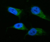 Immunofluorescent staining of FFPE human MG-63 cells with HADHA antibody (green) and DAPI nuclear stain (blue). HIER: steam section in pH6 citrate buffer for 20 min.