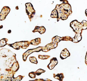 Immunohistochemical staining of HADHA using anti-HADHA antibody. HADHA was detected in a paraffin-embedded section of human placental tissue. Heat mediated antigen retrieval was performed in EDTA buffer (pH 8.0, epitope retrieval solution). The tissue section was blocked with 10% goat serum. The tissue section was then incubated with 2 ug/ml rabbit anti-HADHA antibody overnight at 4oC. Peroxidase Conjugated Goat Anti-rabbit IgG was used as secondary antibody and incubated for 30 minutes at 37oC. The tissue section was developed using an HRP secondary and DAB substrate.