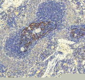 Immunohistochemical staining of GLIPR2 using anti-GLIPR2 antibody. GLIPR2 was detected in a paraffin-embedded section of rat spleen tissue. Heat mediated antigen retrieval was performed in EDTA buffer (pH 8.0, epitope retrieval solution). The tissue section was blocked with 10% goat serum. The tissue section was then incubated with 2 ug/ml rabbit anti-GLIPR2 antibody overnight at 4oC. Peroxidase Conjugated Goat Anti-rabbit IgG was used as secondary antibody and incubated for 30 minutes at 37oC. The tissue section was developed using an HRP secondary and DAB substrate.