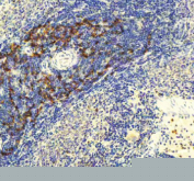 Immunohistochemical staining of GLIPR2 using anti-GLIPR2 antibody. GLIPR2 was detected in a paraffin-embedded section of rat spleen tissue. Heat mediated antigen retrieval was performed in EDTA buffer (pH 8.0, epitope retrieval solution). The tissue section was blocked with 10% goat serum. The tissue section was then incubated with 2 ug/ml rabbit anti-GLIPR2 antibody overnight at 4oC. Peroxidase Conjugated Goat Anti-rabbit IgG was used as secondary antibody and incubated for 30 minutes at 37oC. The tissue section was developed using an HRP secondary and DAB substrate.