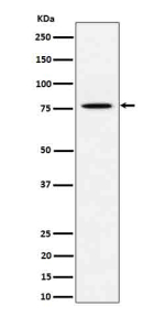 Western blot analysis of PSIP1 / LEDGF expression in human HeLa cell lysate using PSIP1 antibody. Although the predicted molecular weight of the p75 isoform is ~55 kDa, it migrates at ~70-75 kDa due to its highly acidic, proline-rich composition and phosphorylation, consistent with published reports for this chromatin-associated protein.