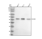 Western blot analysis of NAT12/NAA30 using anti-NAA30 antibody. Electrophoresis was performed on a 10% SDS-PAGE gel at 80V (Stacking gel) / 120V (Resolving gel) for 2 hours. Lane 1: human MCF-7 whole cell lysates, Lane 2: human PC-3 whole cell lysates, Lane 3: human Caco-2 whole cell lysates. After electrophoresis, proteins were transferred to a nitrocellulose membrane at 150 mA for 50-90 minutes. Blocked the membrane with 5% non-fat milk/TBS for 1.5 hour at RT. The membrane was incubated with rabbit anti-NAA30 antibody at 0.5 ug/ml overnight at 4oC, then washed with TBS-0.1%Tween 3 times with 5 minutes each and probed with a goat anti-rabbit IgG-HRP secondary antibody at a dilution of 1:5000 for 1.5 hour at RT. The signal was developed using an ECL Plus Western Blotting Substrate. The predicted molecular weight of NAT12/NAA30 is at ~39 kDa.