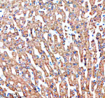 Immunohistochemical staining of SHARPIN using anti-SHARPIN antibody. SHARPIN was detected in a paraffin-embedded section of human liver tissue. Heat mediated antigen retrieval was performed in EDTA buffer (pH 8.0, epitope retrieval solution). The tissue section was blocked with 10% goat serum. The tissue section was then incubated with 2 ug/ml rabbit anti-SHARPIN antibody overnight at 4oC. Peroxidase Conjugated Goat Anti-rabbit IgG was used as secondary antibody and incubated for 30 minutes at 37oC. The tissue section was developed using an HRP secondary and DAB substrate.