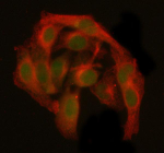 Immunofluorescent staining of GANP/MCM3AP using anti-MCM3AP antibody (green) and anti-Beta Tubulin antibody (red). GANP/MCM3AP was detected in immunocytochemical section of HELA cell. Enzyme antigen retrieval was performed using IHC enzyme antigen retrieval reagent for 15 mins. The cells were blocked with 10% goat serum. And then incubated with 5 ug/ml rabbit anti-MCM3AP antibody and mouse anti-Beta Tubulin antibody overnight at 4oC. DyLight 488 Conjugated Goat Anti-Rabbit IgG and Cy3 Conjugated Goat Anti-Mouse IgG were used as secondary antibody at 1:500 dilution and incubated for 30 minutes at 37oC. Visualize using a fluorescence microscope and filter sets appropriate for the label used.