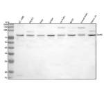 Western blot analysis of GARS1 using anti-GARS1 antibody. Lane 1: human HT-1080 whole cell lysates, Lane 2: human HepG2 whole cell lysates, Lane 3: human Hela whole cell lysates, Lane 4: human Jurkat whole cell lysates, Lane 5: rat brain tissue lysates, Lane 6: rat RH35 whole cell lysates, Lane 7: mouse brain tissue lysates, Lane 8: mouse Neuro-2a whole cell lysates. After electrophoresis, proteins were transferred to a nitrocellulose membrane at 150 mA for 50-90 minutes. Blocked the membrane with 5% non-fat milk/TBS for 1.5 hour at RT. The membrane was incubated with rabbit anti-GARS1 antibody at 0.5 ug/ml overnight at 4oC, then washed with TBS-0.1%Tween 3 times with 5 minutes each and probed with a goat anti-rabbit IgG-HRP secondary antibody at a dilution of 1:5000 for 1.5 hour at RT. The signal was developed using enhanced chemiluminescent. The expected molecular weight of GARS1 is ~83 kDa.