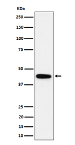 Western blot analysis of GALT expression in human K562 cell lysate using GALT antibody. Predicted molecular weight ~43 kDa.