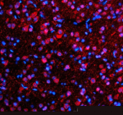 Immunofluorescent staining of SFXN4 using anti-SFXN4 antibody (red). SFXN4 was detected in a paraffin-embedded section of rat brain tissue. Heat mediated antigen retrieval was performed in EDTA buffer (pH 8.0, epitope retrieval solution). The tissue section was blocked with 10% goat serum. The tissue section was then incubated with 5 ug/ml rabbit anti-SFXN4 antibody overnight at 4oC. Cy3 Conjugated Goat Anti-Rabbit IgG was used as secondary antibody at 1:500 dilution and incubated for 30 minutes at 37oC. The section was counterstained with DAPI nuclear stain (blue). Visualize using a fluorescence microscope and filter sets appropriate for the label used.