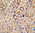 Immunohistochemical staining of SFXN4 using anti-SFXN4 antibody. SFXN4 was detected in a paraffin-embedded section of rat brain tissue. Heat mediated antigen retrieval was performed in EDTA buffer (pH 8.0, epitope retrieval solution). The tissue section was blocked with 10% goat serum. The tissue section was then incubated with 2 ug/ml rabbit anti-SFXN4 antibody overnight at 4oC. Peroxidase Conjugated Goat Anti-rabbit IgG was used as secondary antibody and incubated for 30 minutes at 37oC. The tissue section was developed using an HRP secondary and DAB substrate.
