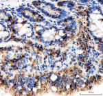 Immunohistochemical staining of APH1A using anti-APH1A antibody. APH1A was detected in a paraffin-embedded section of rat colon tissue. Heat mediated antigen retrieval was performed in EDTA buffer (pH 8.0, epitope retrieval solution). The tissue section was blocked with 10% goat serum. The tissue section was then incubated with 2 ug/ml rabbit anti-APH1A antibody overnight at 4oC. Peroxidase Conjugated Goat Anti-rabbit IgG was used as secondary antibody and incubated for 30 minutes at 37oC. The tissue section was developed using an HRP secondary and DAB substrate.