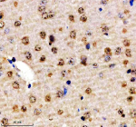 Immunohistochemical staining of SON using anti-SON antibody. SON was detected in a paraffin-embedded section of mouse brain tissue. Heat mediated antigen retrieval was performed in EDTA buffer (pH 8.0, epitope retrieval solution). The tissue section was blocked with 10% goat serum. The tissue section was then incubated with 2 ug/ml rabbit anti-SON antibody overnight at 4oC. Peroxidase Conjugated Goat Anti-rabbit IgG was used as secondary antibody and incubated for 30 minutes at 37oC. The tissue section was developed using an HRP secondary and DAB substrate.