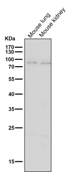 Western blot testing of mouse samples with the BDKRB2 antibody at 1:3000 dilution for 1 hour at room temperature. Predicted molecular weight ~78 kDa.