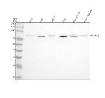 Western blot analysis of BDKRB2 using anti-BDKRB2 antibody. Lane 1: human Hela whole cell lysates, Lane 2: human 293T whole cell lysates, Lane 3: human MCF-7 whole cell lysates, Lane 4: human K562 whole cell lysates, Lane 5: mouse lung tissue lysates, Lane 6: mouse kidney tissue lysates. After electrophoresis, proteins were transferred to a nitrocellulose membrane at 150 mA for 50-90 minutes. Blocked the membrane with 5% non-fat milk/TBS for 1.5 hour at RT. The membrane was incubated with rabbit anti-BDKRB2 antibody at 1:500 overnight at 4oC, then washed with TBS-0.1%Tween 3 times with 5 minutes each and probed with a goat anti-rabbit IgG-HRP secondary antibody at a dilution of 1:500 for 1.5 hour at RT. The signal was developed using enhanced chemiluminescent. A specific band was detected for BDKRB2 at approximately 78 kDa. The expected molecular weight of BDKRB2 is ~78 kDa.