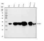 Western blot analysis of STARD10 using anti-STARD10 antibody. Lane 1: human RT4 whole cell lysates, Lane 2: human MCF-7 whole cell lysates, Lane 3: human T47D whole cell lysates, Lane 4: rat liver tissue lysates, Lane 5: mouse liver tissue lysates, Lane 6: mouse HEPA1-6 whole cell lysates. After electrophoresis, proteins were transferred to a nitrocellulose membrane at 150 mA for 50-90 minutes. Blocked the membrane with 5% non-fat milk/TBS for 1.5 hour at RT. The membrane was incubated with rabbit anti-STARD10 antibody at 0.5 ug/ml overnight at 4oC, then washed with TBS-0.1%Tween 3 times with 5 minutes each and probed with a goat anti-rabbit IgG-HRP secondary antibody at a dilution of 1:5000 for 1.5 hour at RT. The signal was developed using enhanced chemiluminescent. Although the theoretical mass is ~33 kDa, STARD10 typically migrates at ~35-38 kDa on SDS-PAGE, consistent with reported behavior of START-domain proteins and minor post-translational modifications.