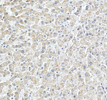 Immunohistochemical staining of STARD10 using anti-STARD10 antibody. STARD10 was detected in a paraffin-embedded section of human liver tissue. Heat mediated antigen retrieval was performed in EDTA buffer (pH 8.0, epitope retrieval solution). The tissue section was blocked with 10% goat serum. The tissue section was then incubated with 2 ug/ml rabbit anti-STARD10 antibody overnight at 4oC. Peroxidase Conjugated Goat Anti-rabbit IgG was used as secondary antibody and incubated for 30 minutes at 37oC. The tissue section was developed using an HRP secondary and DAB substrate.