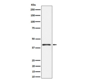 Western blot analysis of Phospho-p38 (T180) expression in lysate from HeLa cells treated with anisomycin, using Phospho-p38 (Thr180) antibody. Expected molecular weight ~38 kDa.