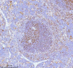 Immunohistochemical staining of Lat using anti-Lat antibody. Lat was detected in a paraffin-embedded section of mouse spleen tissue. Heat mediated antigen retrieval was performed in EDTA buffer (pH 8.0, epitope retrieval solution). The tissue section was blocked with 10% goat serum. The tissue section was then incubated with 2 ug/ml rabbit anti-Lat antibody overnight at 4oC. Peroxidase Conjugated Goat Anti-rabbit IgG was used as secondary antibody and incubated for 30 minutes at 37oC. The tissue section was developed using an HRP secondary and DAB substrate.