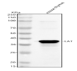Western blot analysis of Lat using anti-Lat antibody. Lane 1: mouse thymus tissue lysates. After electrophoresis, proteins were transferred to a nitrocellulose membrane at 150 mA for 50-90 minutes. Blocked the membrane with 5% non-fat milk/TBS for 1.5 hour at RT. The membrane was incubated with rabbit anti-Lat antibody at 0.25 ug/ml overnight at 4oC, then washed with TBS-0.1%Tween 3 times with 5 minutes each and probed with a goat anti-rabbit IgG-HRP secondary antibody at a dilution of 1:5000 for 1.5 hour at RT. The signal was developed using enhanced chemiluminescent. Although the theoretical molecular weight of Lat is ~26 kDa, it migrates at ~38 kDa due to palmitoylation and multiple tyrosine phosphorylation sites that retard electrophoretic mobility.