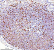 Immunohistochemical staining of Lat using anti-Lat antibody. Lat was detected in a paraffin-embedded section of rat lymph node tissue. Heat mediated antigen retrieval was performed in EDTA buffer (pH 8.0, epitope retrieval solution). The tissue section was blocked with 10% goat serum. The tissue section was then incubated with 2 ug/ml rabbit anti-Lat antibody overnight at 4oC. Peroxidase Conjugated Goat Anti-rabbit IgG was used as secondary antibody and incubated for 30 minutes at 37oC. The tissue section was developed using an HRP secondary and DAB substrate.