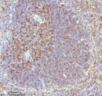 Immunohistochemical staining of Lat using anti-Lat antibody. Lat was detected in a paraffin-embedded section of mouse spleen tissue. Heat mediated antigen retrieval was performed in EDTA buffer (pH 8.0, epitope retrieval solution). The tissue section was blocked with 10% goat serum. The tissue section was then incubated with 2 ug/ml rabbit anti-Lat antibody overnight at 4oC. Peroxidase Conjugated Goat Anti-rabbit IgG was used as secondary antibody and incubated for 30 minutes at 37oC. The tissue section was developed using an HRP secondary and DAB substrate.