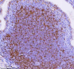 Immunohistochemical staining of Lat using anti-Lat antibody. Lat was detected in a paraffin-embedded section of mouse intestinal lymph nodes tissue. Heat mediated antigen retrieval was performed in EDTA buffer (pH 8.0, epitope retrieval solution). The tissue section was blocked with 10% goat serum. The tissue section was then incubated with 2 ug/ml rabbit anti-Lat antibody overnight at 4oC. Peroxidase Conjugated Goat Anti-rabbit IgG was used as secondary antibody and incubated for 30 minutes at 37oC. The tissue section was developed using an HRP secondary and DAB substrate.
