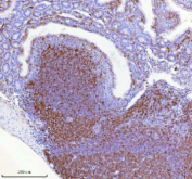 Immunohistochemical staining of Lat using anti-Lat antibody. Lat was detected in a paraffin-embedded section of mouse intestinal lymph nodes tissue. Heat mediated antigen retrieval was performed in EDTA buffer (pH 8.0, epitope retrieval solution). The tissue section was blocked with 10% goat serum. The tissue section was then incubated with 2 ug/ml rabbit anti-Lat antibody overnight at 4oC. Peroxidase Conjugated Goat Anti-rabbit IgG was used as secondary antibody and incubated for 30 minutes at 37oC. The tissue section was developed using an HRP secondary and DAB substrate.