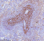 Immunohistochemical staining of Lat using anti-Lat antibody. Lat was detected in a paraffin-embedded section of rat spleen tissue. Heat mediated antigen retrieval was performed in EDTA buffer (pH 8.0, epitope retrieval solution). The tissue section was blocked with 10% goat serum. The tissue section was then incubated with 2 ug/ml rabbit anti-Lat antibody overnight at 4oC. Peroxidase Conjugated Goat Anti-rabbit IgG was used as secondary antibody and incubated for 30 minutes at 37oC. The tissue section was developed using an HRP secondary and DAB substrate.