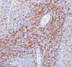Immunohistochemical staining of Lat using anti-Lat antibody. Lat was detected in a paraffin-embedded section of rat spleen tissue. Heat mediated antigen retrieval was performed in EDTA buffer (pH 8.0, epitope retrieval solution). The tissue section was blocked with 10% goat serum. The tissue section was then incubated with 2 ug/ml rabbit anti-Lat antibody overnight at 4oC. Peroxidase Conjugated Goat Anti-rabbit IgG was used as secondary antibody and incubated for 30 minutes at 37oC. The tissue section was developed using an HRP secondary and DAB substrate.