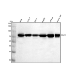 Western blot analysis of SOAT1 using anti-SOAT1 antibody. Lane 1: human Hela whole cell lysates, Lane 2: human HUH-7 whole cell lysates, Lane 3: human THP-1 whole cell lysates, Lane 4: human HepG2 whole cell lysates, Lane 5: rat liver tissue lysates, Lane 6: mouse liver tissue lysates. After electrophoresis, proteins were transferred to a nitrocellulose membrane at 150 mA for 50-90 minutes. Blocked the membrane with 5% non-fat milk/TBS for 1.5 hour at RT. The membrane was incubated with rabbit anti-SOAT1 antibody at 0.5 ug/ml overnight at 4oC, then washed with TBS-0.1%Tween 3 times with 5 minutes each and probed with a goat anti-rabbit IgG-HRP secondary antibody at a dilution of 1:5000 for 1.5 hour at RT. The signal was developed using enhanced chemiluminescent. A specific band was detected for SOAT1 at approximately 75 kDa. The expected molecular weight of SOAT1 is ~65 kDa.